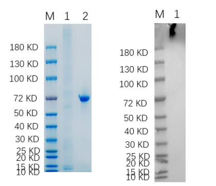 Reducing 4%-20% SDS-PAGE (CBB stained) and WB (Anti-His Mouse Mon centigradelonal Antibody) analysis profiles of purified NF1 Mutant.
1. NF1 Mutant
2. BSA